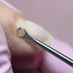 Instrumente*Magnetic The Curette